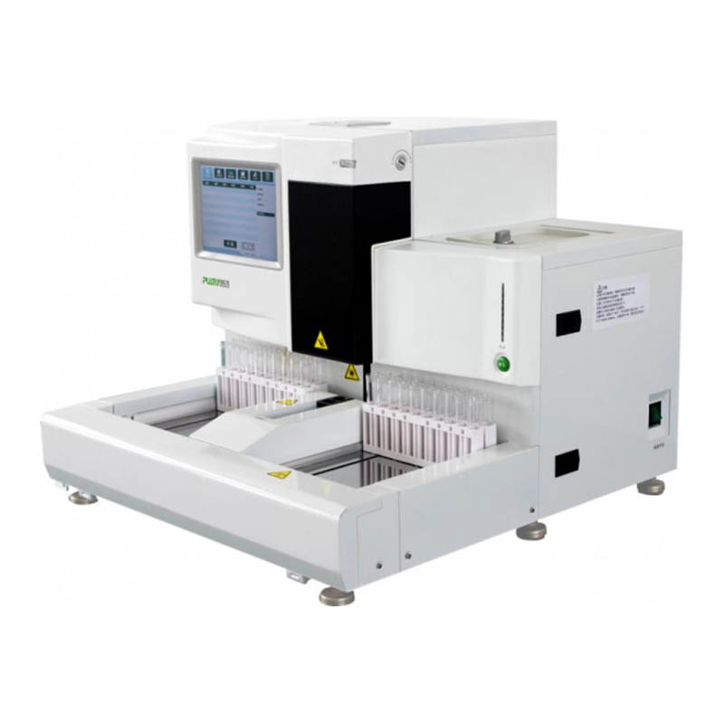Urine -analyserlijsten